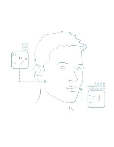 Extracto de Alcachofa BCN