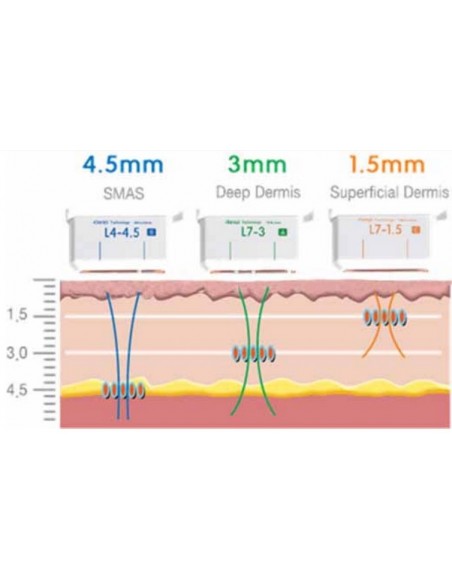 HIFU Rejuvenecimiento  Facial 2 en 1