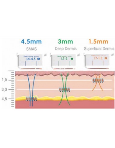 HIFU Rejuvenecimiento  Facial 