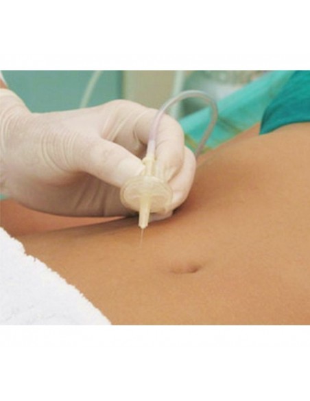 Carboxiterapia 3 kl