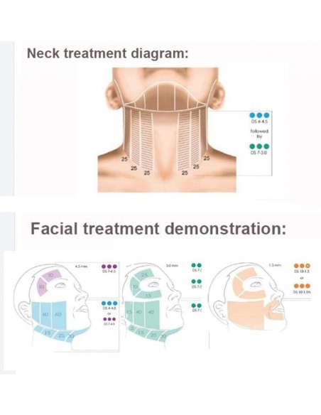 Hifu 3D 7D de 2 mangos corporal y facial
